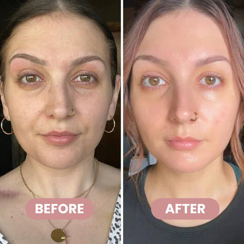 Xaevor® PDRN+Collagen Multi Balm
