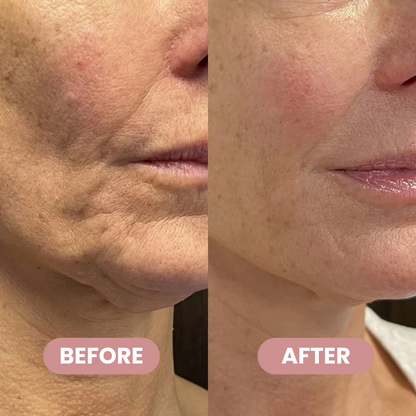Xaevor® PDRN+Collagen Multi Balm