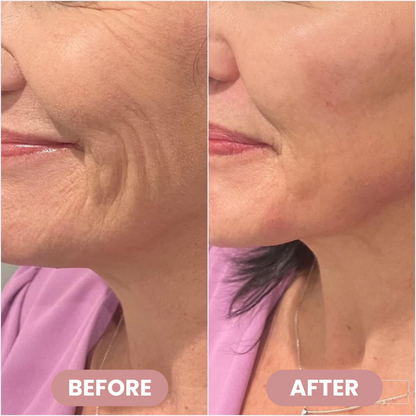Xaevor® PDRN+Collagen Multi Balm